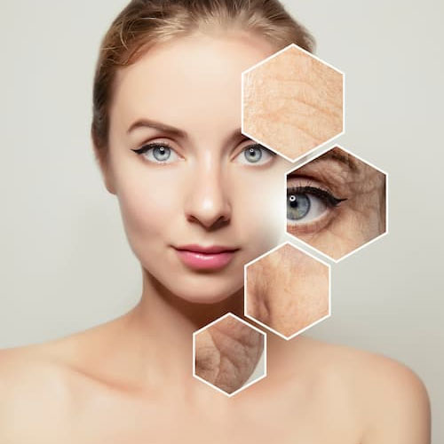anti aging treatment in Hyderabad